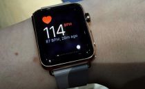 不骗你 Apple Watch真的可以拯救生命的